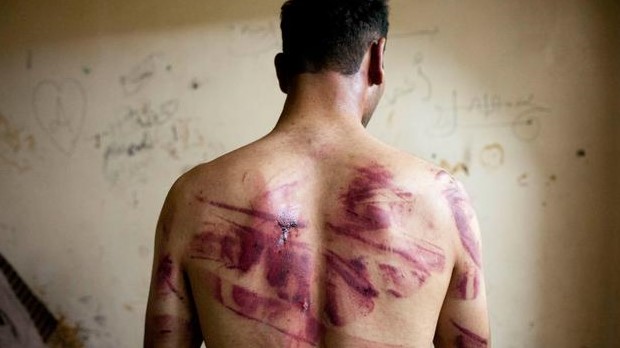 صورة من الأرشيف لمواطن سوري تعرض للتعذيب في أحد سجون نظام دمشق
