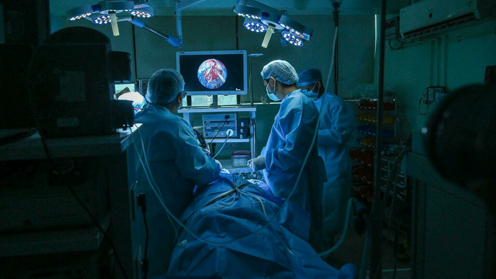 جراحون يزيلون الفطريات السوداء من مريض في مستشفى بمدينة غازي أباد الهندية. بتاريخ 21 تموز/ يوليو 2021
