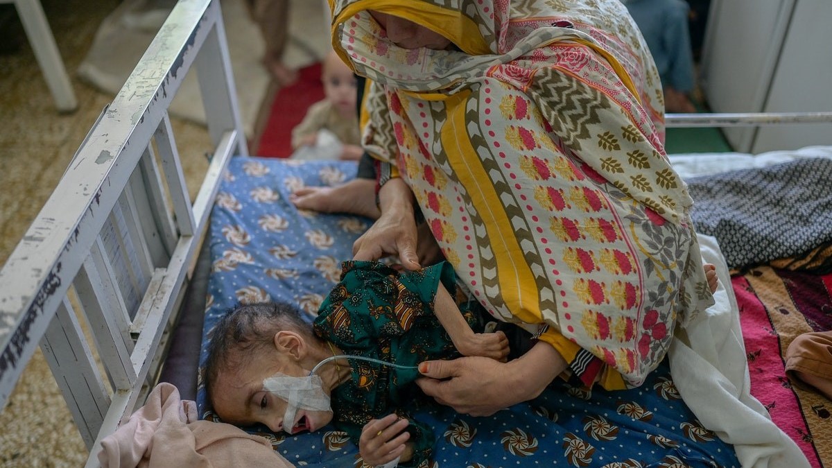 طفل يعاني من سوء تغذية يُعالَج في مستشفى بقندهار في 27 سبتمبر 2021