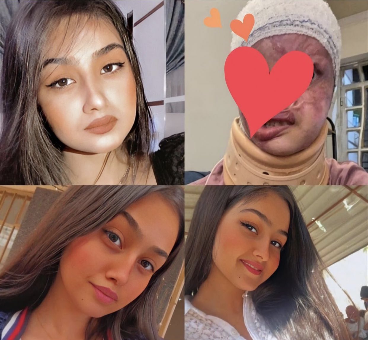 اميرة بغداد مريم الركابي ضحية الاعتداء عليها بالاسيد وقرار بتسفيرها الى الخارج للعلاج الاحد 19 كانون الاول ديسمبر 2021 (تويتر)