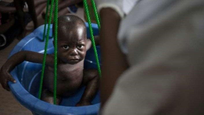وزن طفل في وحدة سوء التغذية في جمهورية أفريقيا الوسطى
