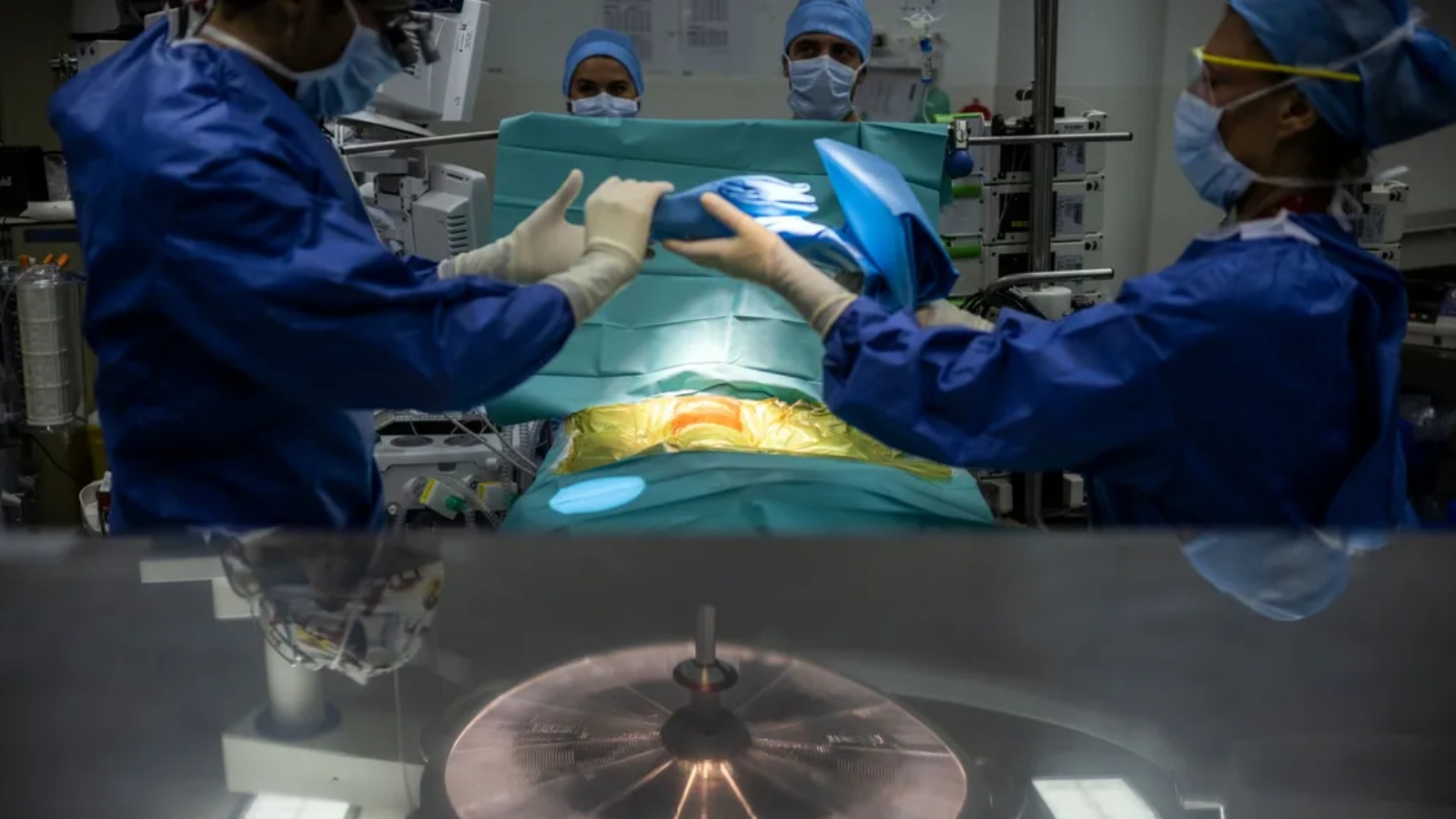 كلية خنزير معدّل وراثياً تم زرعها في جسم إنسان بحالة موت دماغي