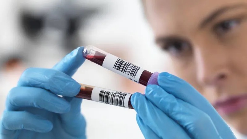 GETTY IMAGES | قد يساعد تحليل الدم الجديد في الكشف المبكر عن أمراض خطيرة، من ثم ترتفع نسب الشفاء