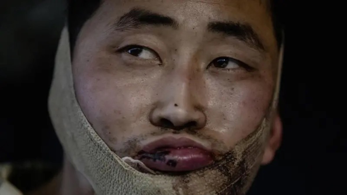 إلى جانب بيانه، شارك الرئيس زيلينسكي صورة لرجل جريح قيل إنه تم القبض عليه في منطقة كورسك الروسية