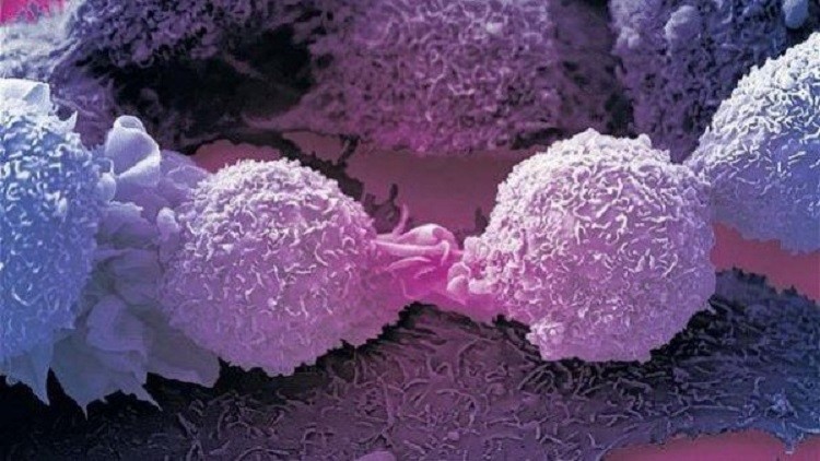 33 % من البشر مصابون بالسرطان