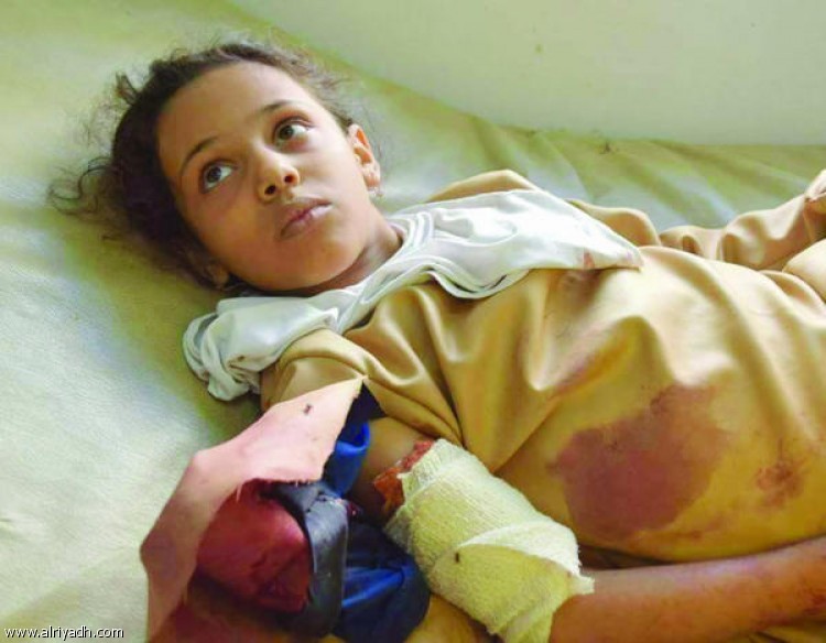 قناصة الحوثي يغتالون الأطفال