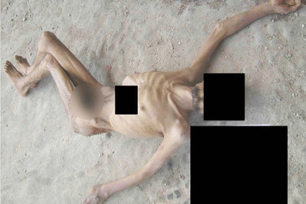 صورة لجثة احد الضحايا 