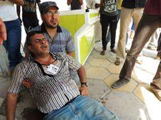 صحافي عراقي تعرض لاعتداء من القوات الامنية