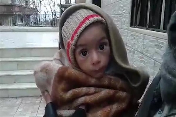 طفلة سورية تعاني سوء التغذية