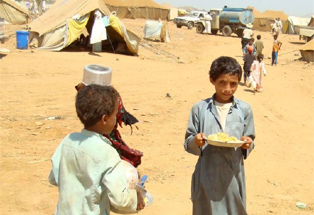 مسؤول أممي محبط لسوء التغذية في اليمن