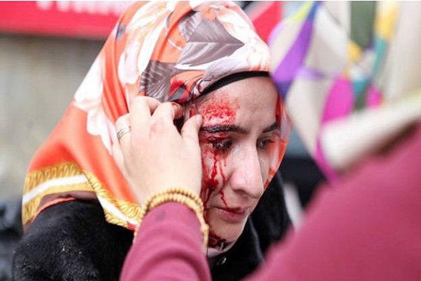 الدماء تغطي وجه صحافية بعد اقتحام الشرطة لصحيفة (زمان)