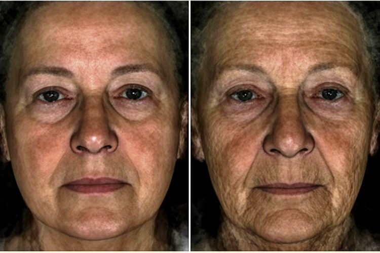 العلماء يكتشفون الجين الذي يمنح الوجه ملامح الشباب