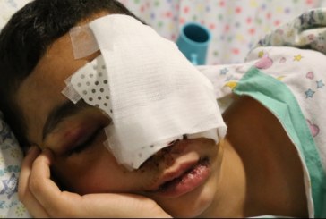 فلسطينيون مصابون بالرصاص الاسفنجي الاسود يعانون من آثار جروح دائمة