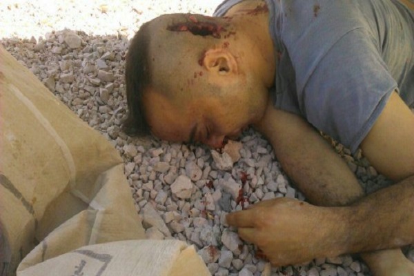 صورة الطيار السوري بعد قتله