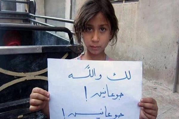 سوء التغذية يهدد أطفال الغوطة الشرقية