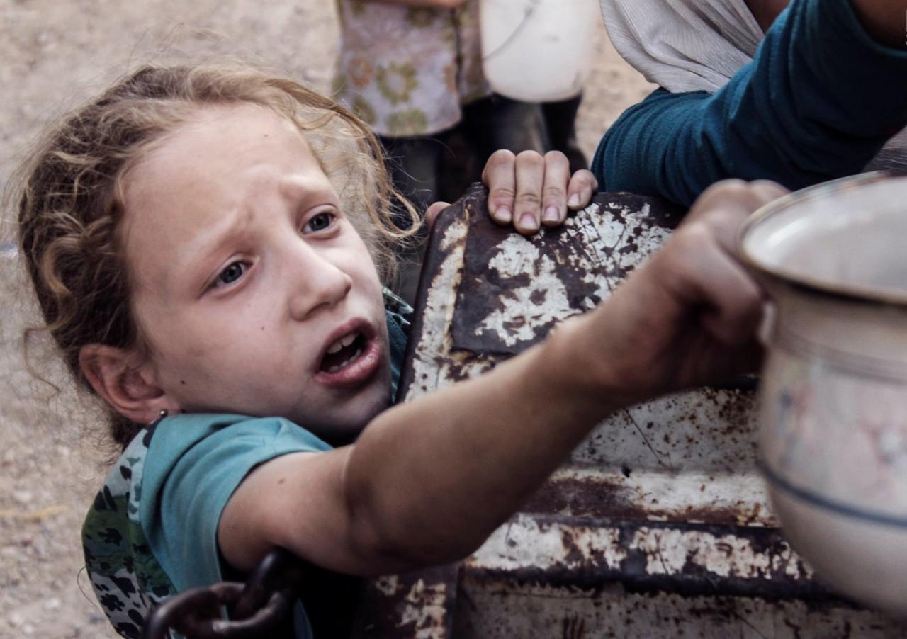 يونيسف: 1100 طفل يعانون من سوء تغذية في الغوطة الشرقية