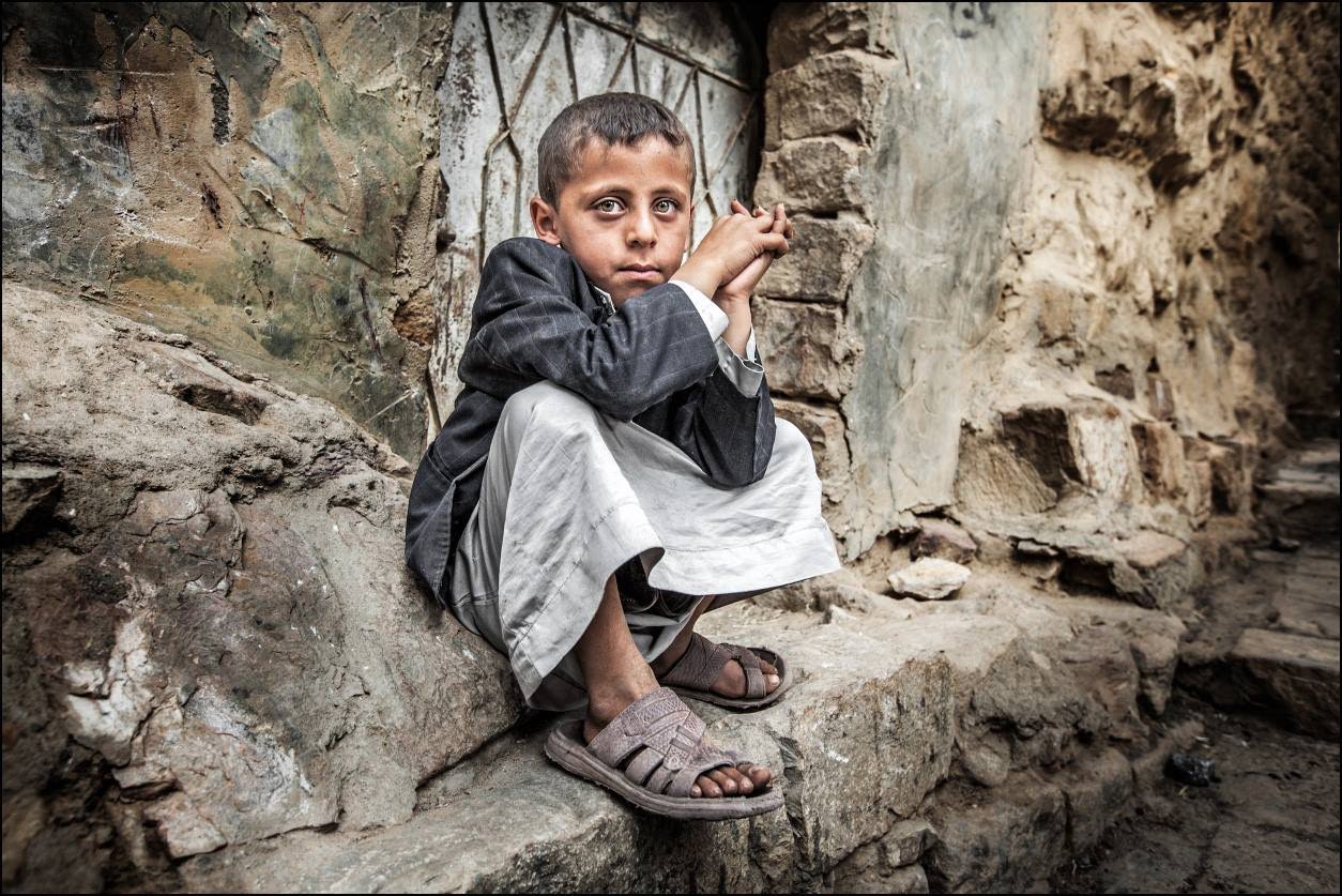 الأمم المتحدة: 11 مليون طفل يمني بحاجة ماسة الى المساعدة