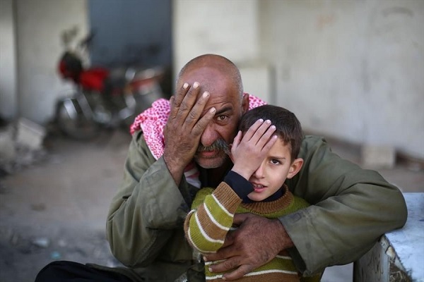 رضيع سوري فقد عينه يتحول رمزاً لمعاناة منطقة محاصرة