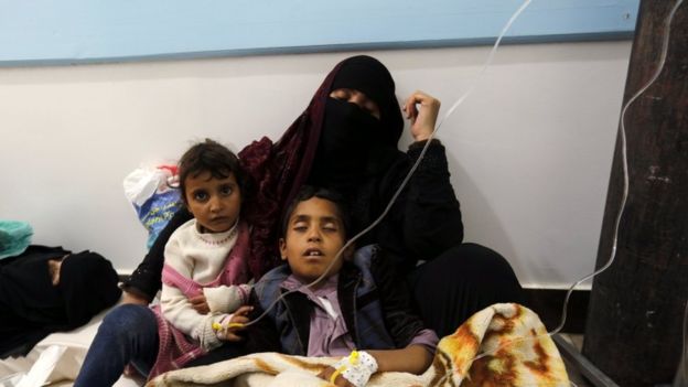 الأمم المتحدة تؤكد 58 إصابة بالكوليرا في اليمن