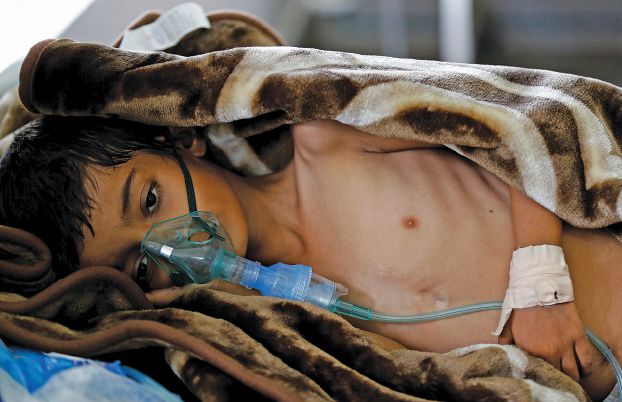 الكوليرا يمكن ان يصيب 850 الف شخص في اليمن
