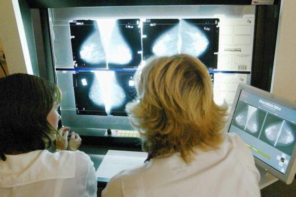 انكلترا توافق على علاج يطيل حياة المصاب بسرطان الرئة