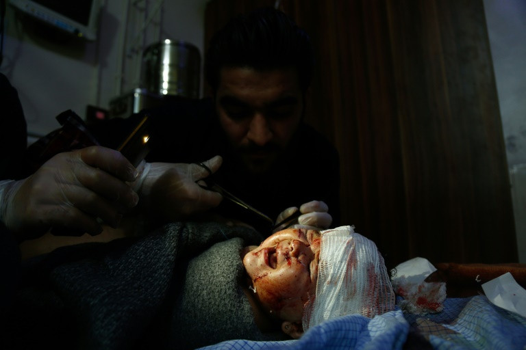 ارتفاع حصيلة القتلى جراء القصف على الغوطة الشرقية الى 28 مدنيا