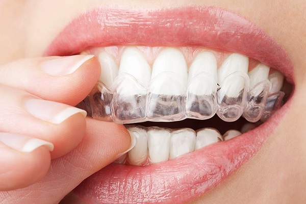 البوتوكس يستخدم في معالجة صرير الأسنان