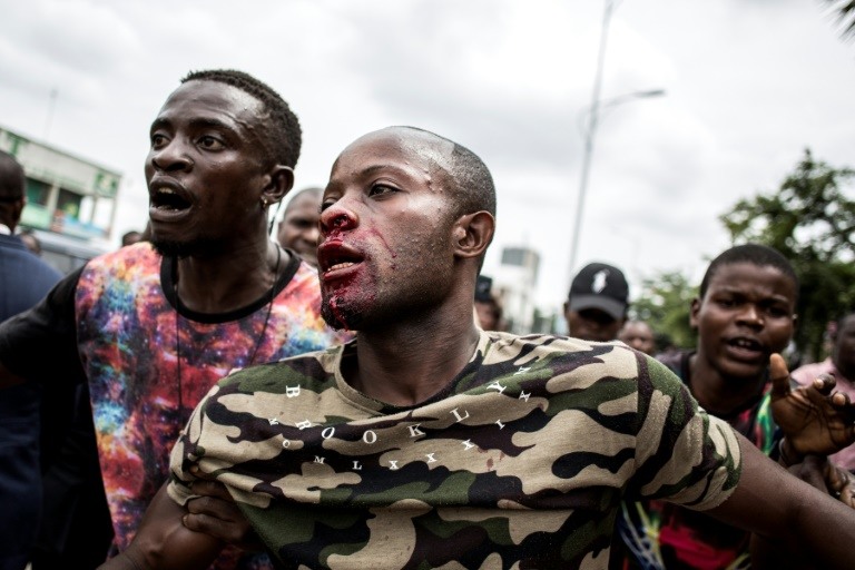 تفريق مسيرة بالرصاص الحي في كيسنغاني بالكونغو الديموقراطية