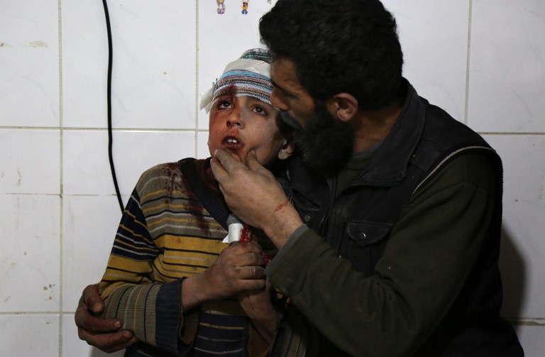 حالات اختناق جديدة في الغوطة بعد قصف للجيش السوري