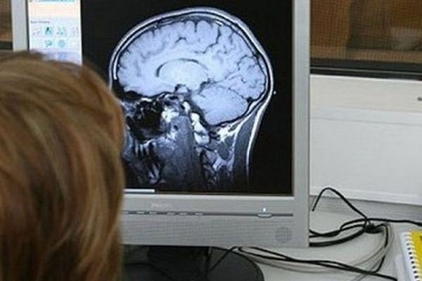 دراسة جديدة: دماغ الانسان يبقى نشيطاً بعد الوفاة