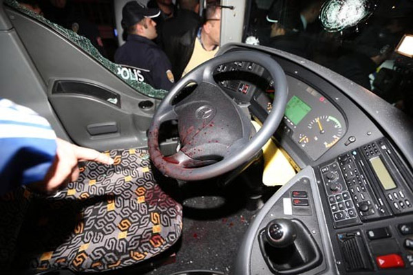 صورة توضح آثار دماء السائق على مقود القيادة