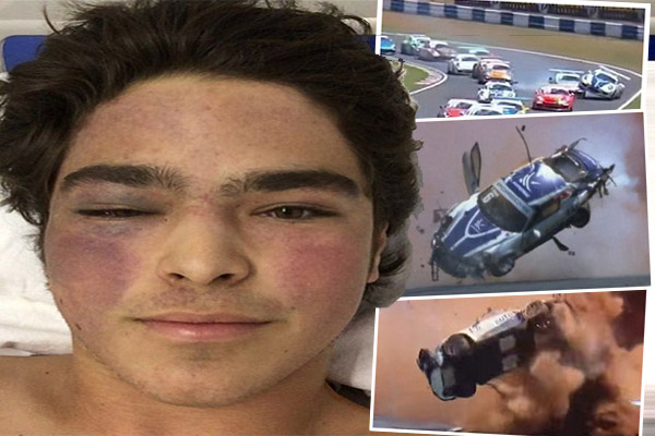 نجا السائق البرازيلي بيدرو بيكيه بأعجوبة من حادث مروع، بعدما تعرضت سيارته للانقلاب تسع مرات
