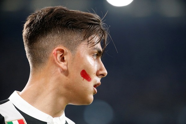 ما سر العلامة الحمراء على وجوه لاعبي الدوري الايطالي ؟
