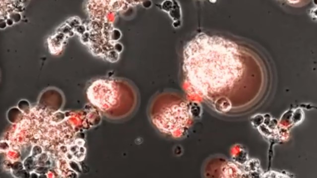 صورة مأخوذة من فيديو مجهري يصور كيف يهاجم فيروس كورونا الخلايا الدماغية