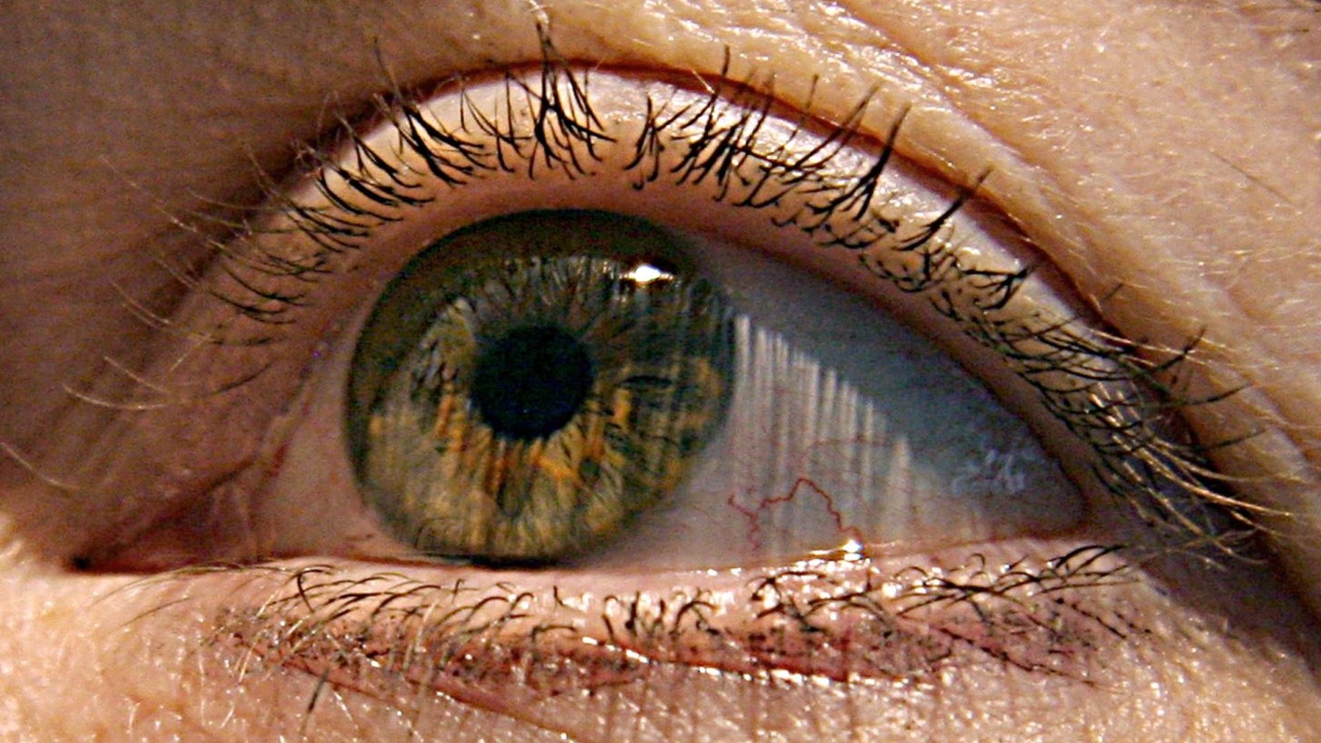 مشكلات العين تزيد خطر الإصابة بالخرف