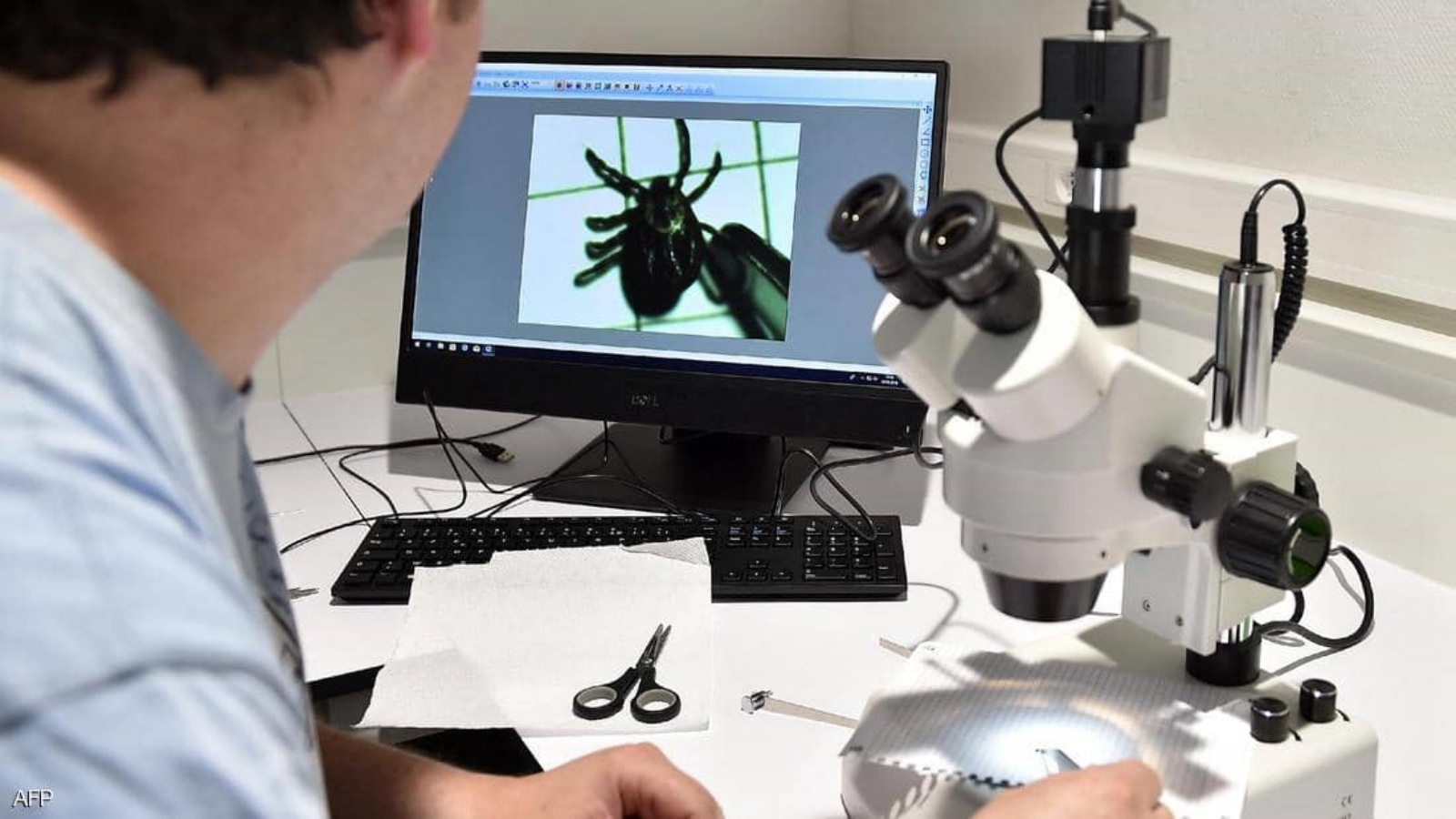 عامل مختبر يتفحص حشرة القراد بجهاز الميكروسكوب. (أرشيفية)