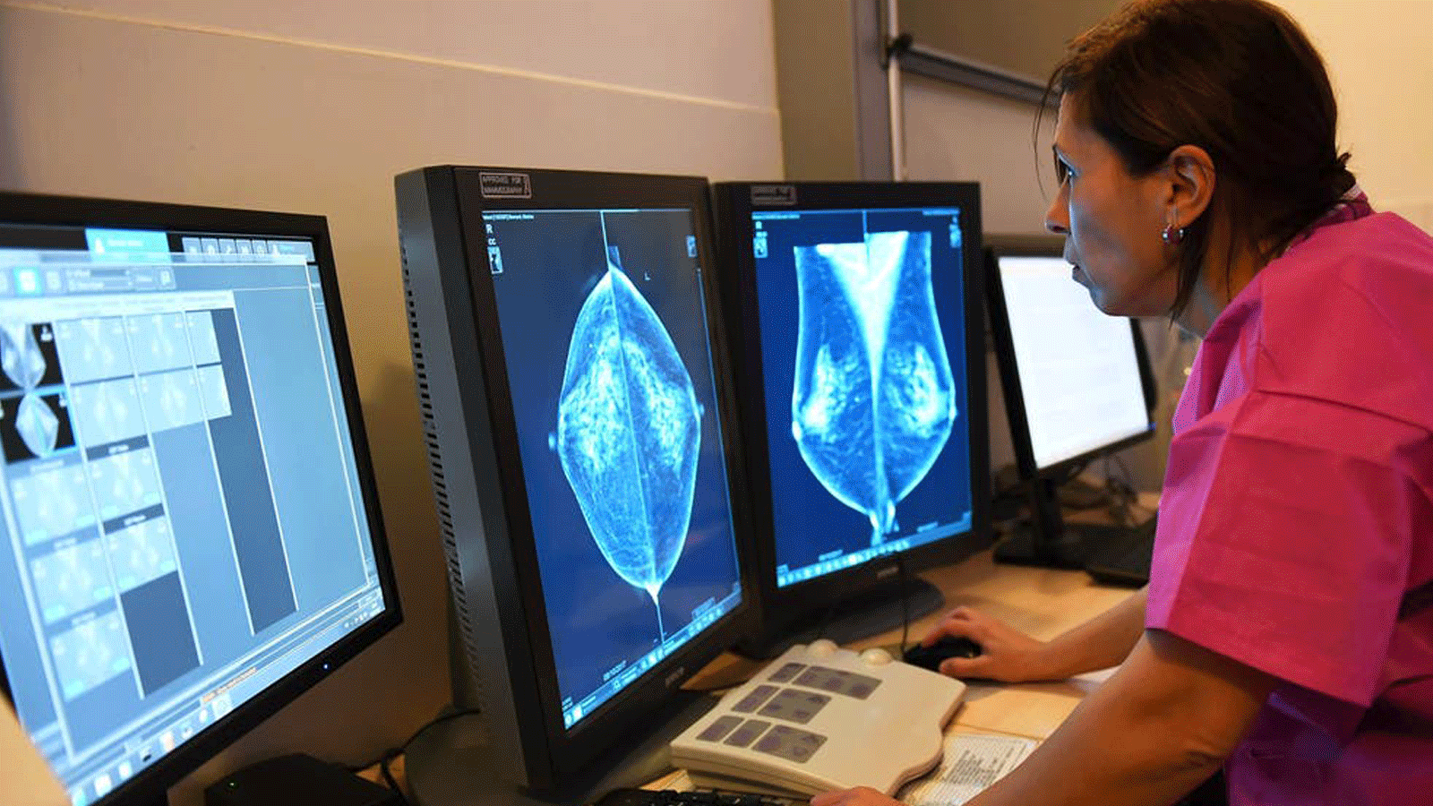 طبيبة تراقب صور أشعة لثدي مصاب بالسرطان