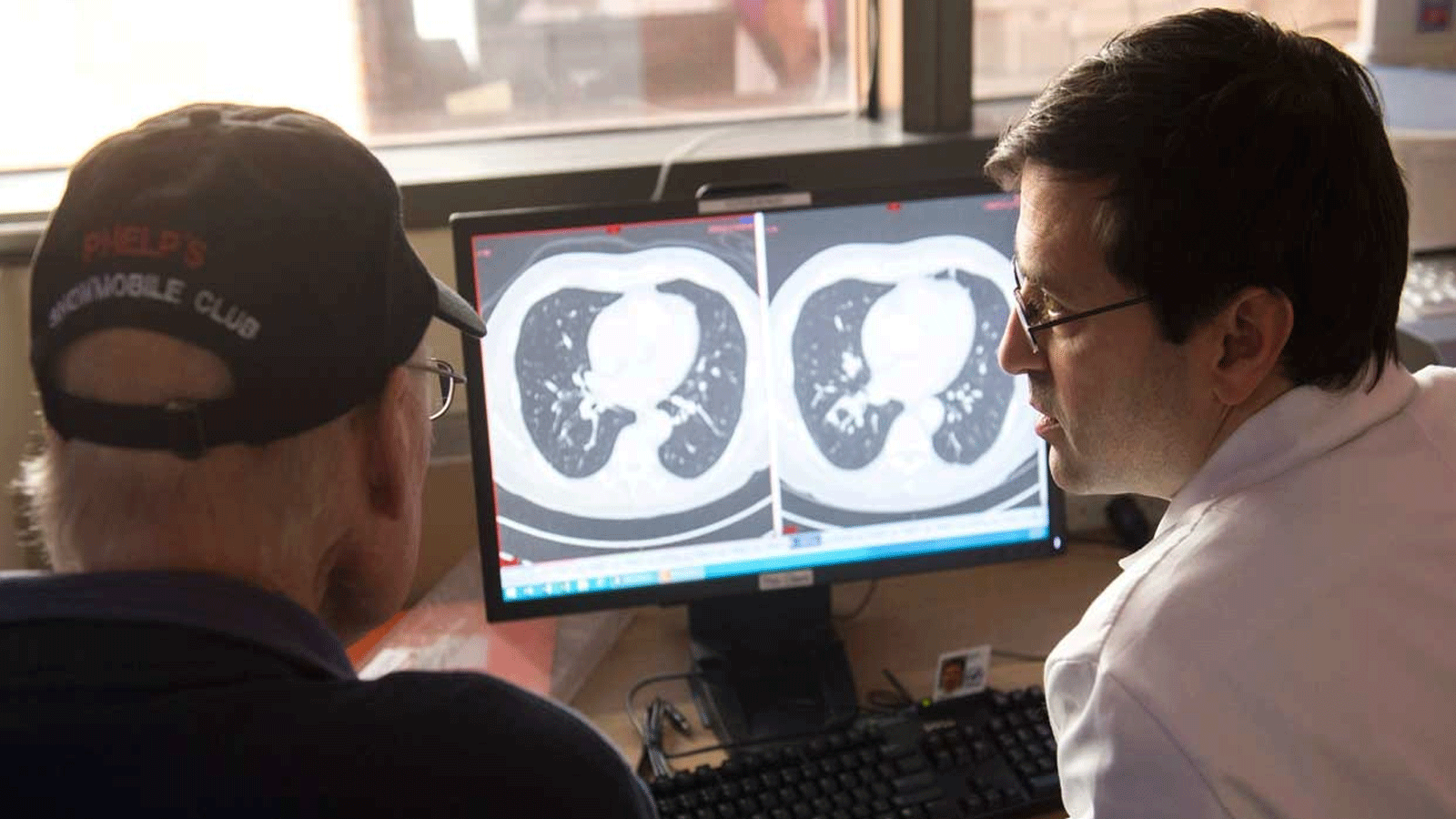 الهيئة العليا للصحة تسعى لإجراء تجارب للكشف عن سرطان الرئة لدى المدخنين.