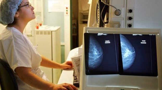 الذكاء الاصطناعي يدرس آلاف الصور الشعاعية ليخرج بتوقعاته عن احتمال حصول سرطان الثدي 