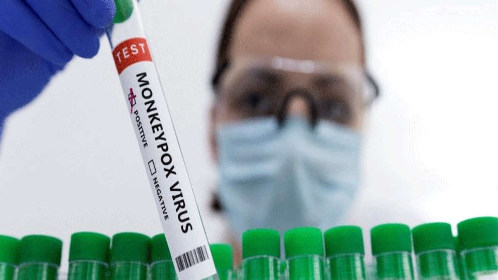 الولايات المتحدة تستعد لتطعيم الأشخاص الذين كانوا على اتصال وثيق بمرضى جدري القردة