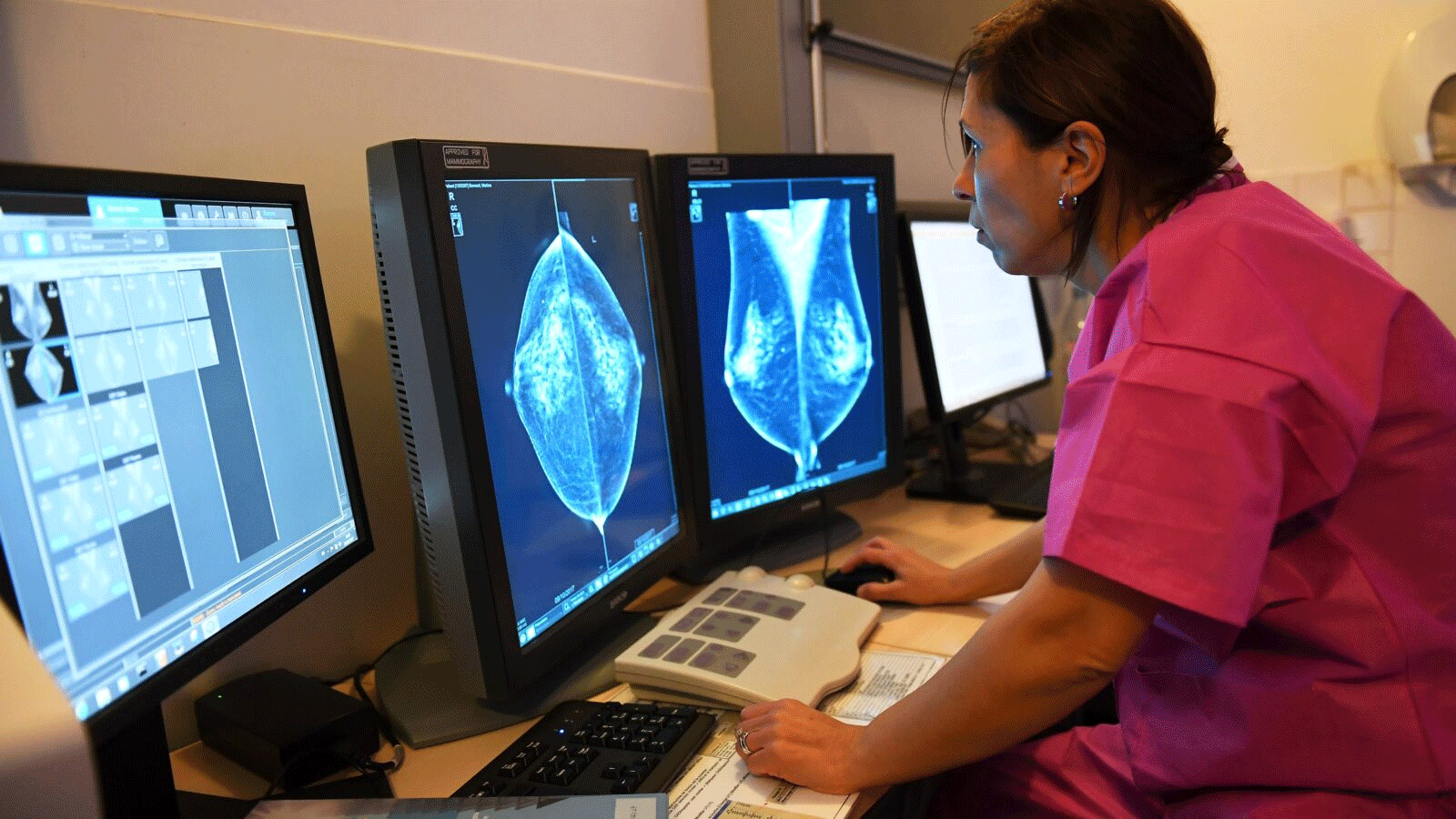 طبيبة تتفحص نتائج التصوير الشعاعي للثدي.