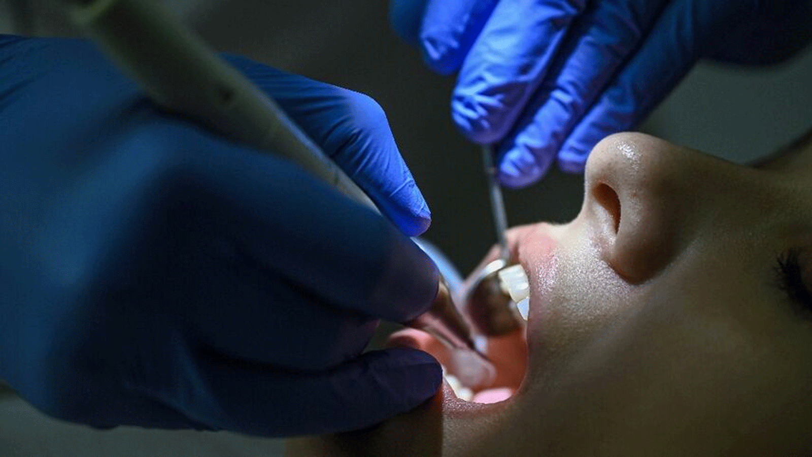 طبيب يعالج أسنان مريضة في تركيا 