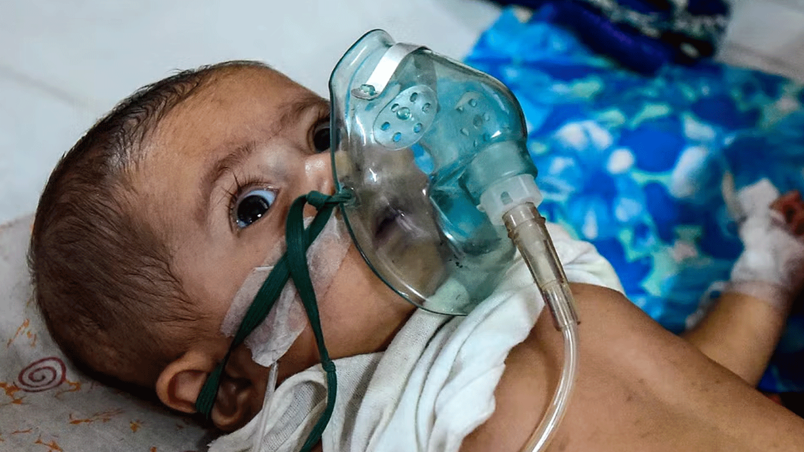 طفل يعاني من مرض تنفسي يتلقى العلاج في دكا