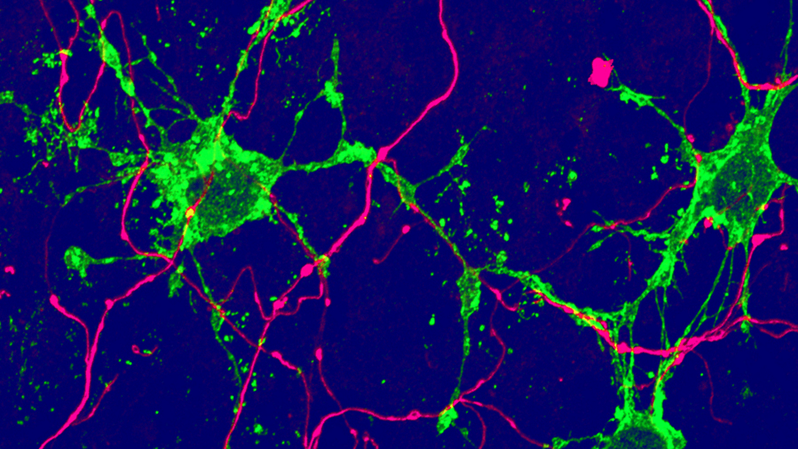 نوع جديد من الخلايا الدبقية (الخضراء) ، ينشأ من الخلايا الجذعية البالغة في الدماغ، ويتلامس مع الخلايا العصبية (أرجواني). (الصورة: جامعة بازل، Biozentrum)