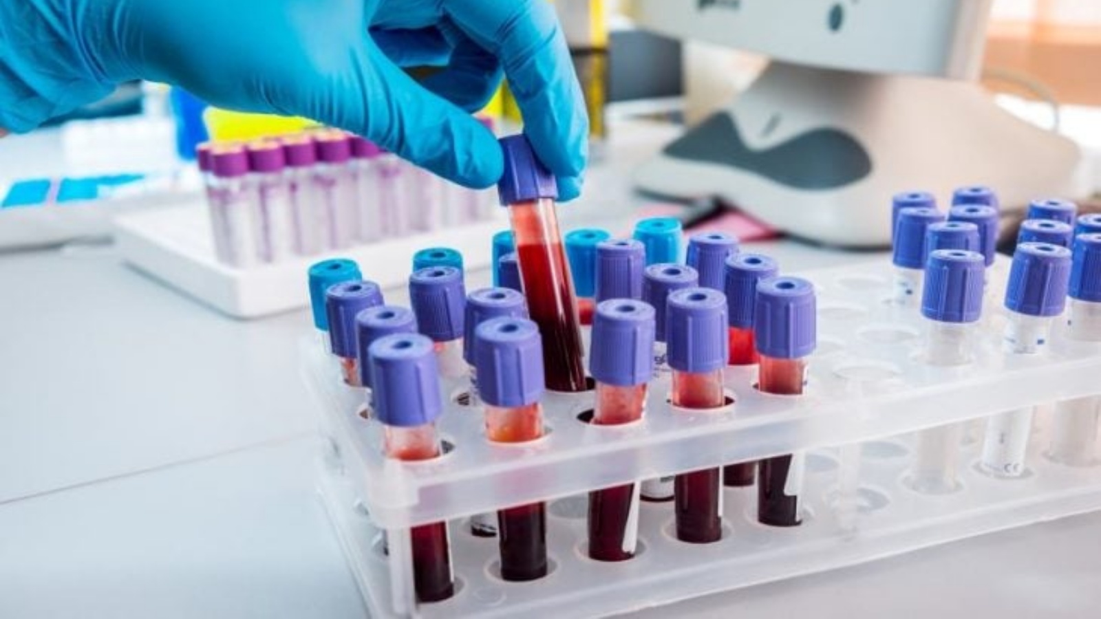 هل يعمد الأطباء قريبا إلى فحص دم لتقييم فاعلية علاج ضد السرطان أو رصد ورم في وقت مبكر للغاية؟