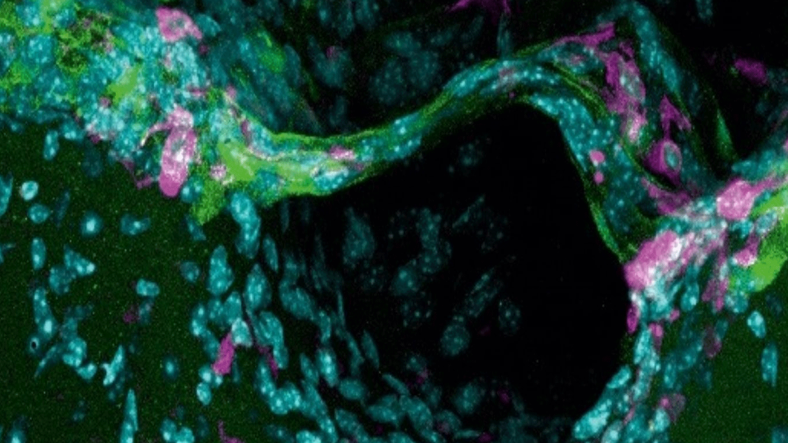 صورة توضيحية من صفحة جامعة روتشستر الأميركية(University of Rochester)