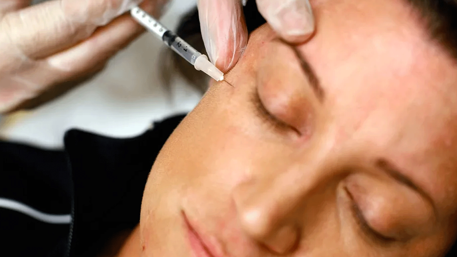 «الصحة المصرية» تُحذّر من خطر حقن البوتكس(صورة توضيحية)