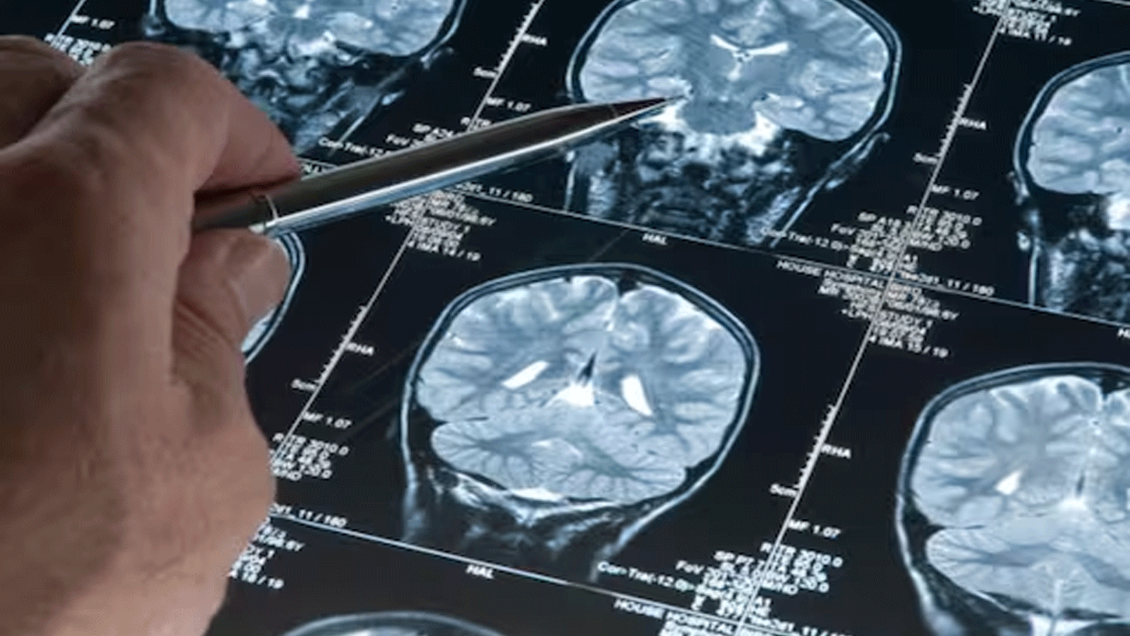 دراسة: الاحتباس الحراري يقلّص حجم الدماغ البشري