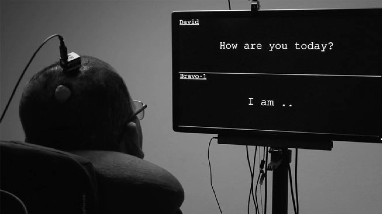 "الأعصاب الكلامية" تقنية جديدة تساعد على ترجمة الإشارات من الدماغ إلى الجهاز الصوتي مباشرة إلى كلمات تظهر كنص على الشاشة.(جامعة كاليفورنيا)