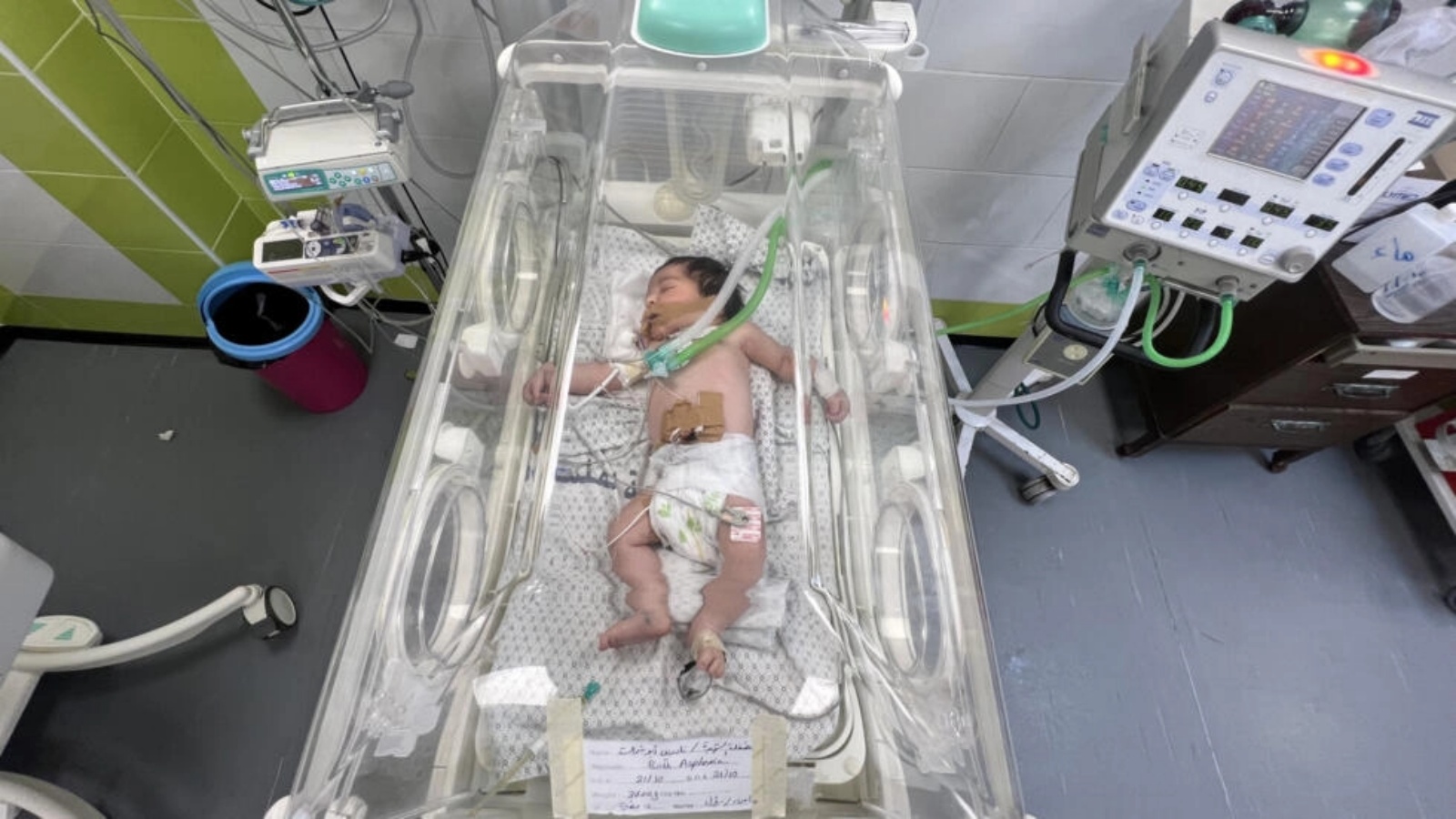 مكة أبو شمالة التي قُتل أخوتها وأمها في غارة إسرائيلية وأمها حامل بها في شهرها التاسع، تتلقى الرعاية داخل حاضنة في مستشفى برفح في 23 تشرين الأول (أكتوبر) 2023